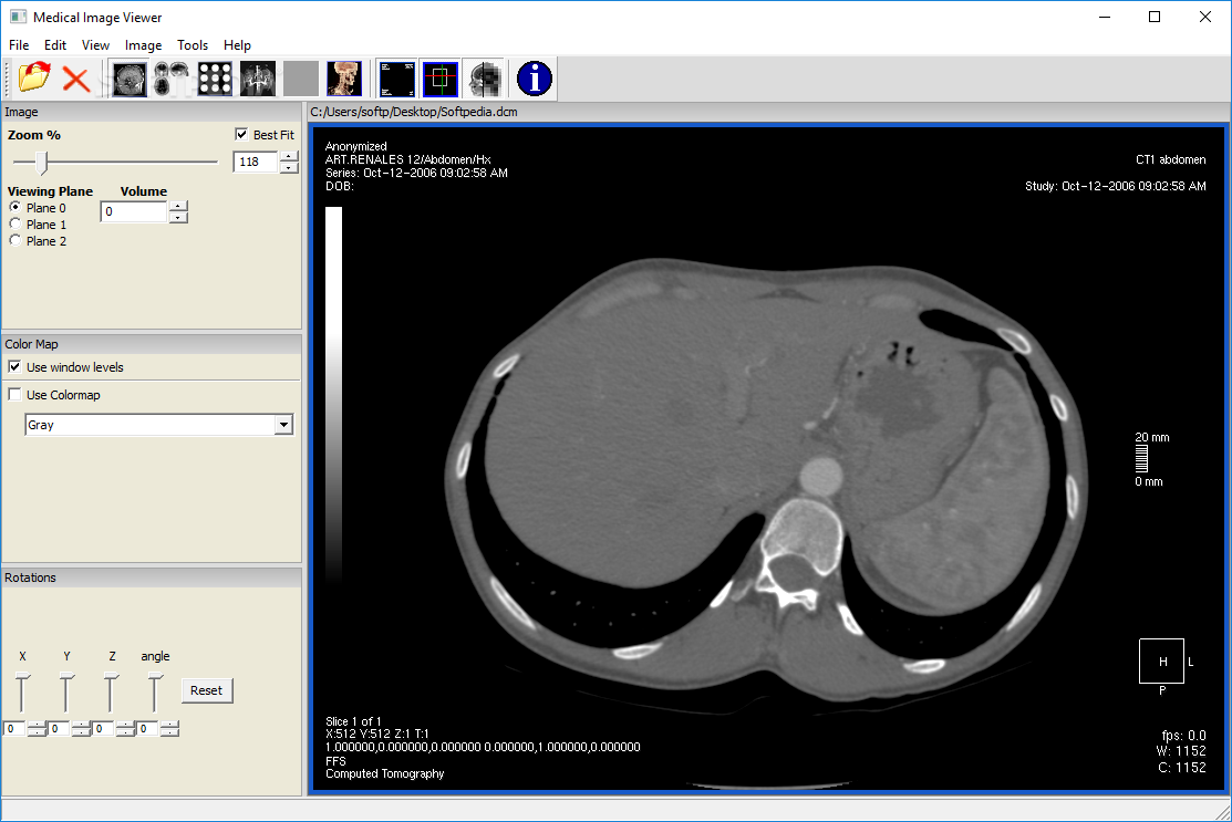 Medical Image Viewer (MIView)