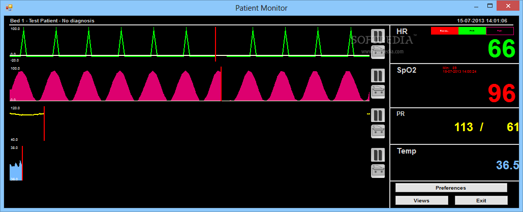 Patient Monitor