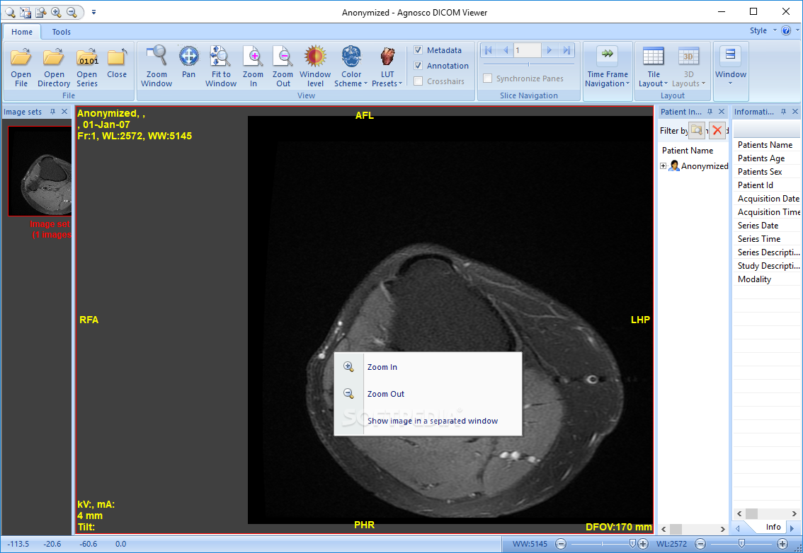 Portable Agnosco DICOM Viewer