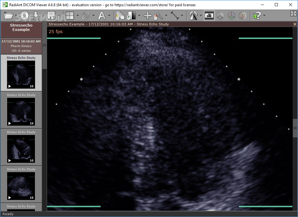 Top 24 Portable Software Apps Like Portable RadiAnt DICOM Viewer - Best Alternatives